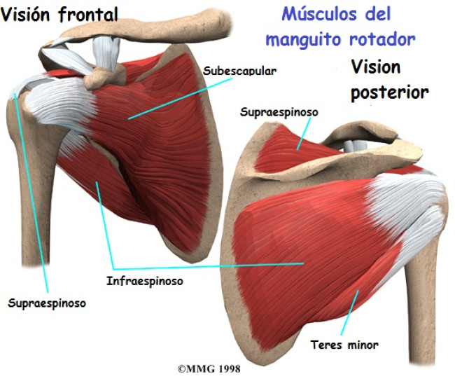 Tendinitis del supraespinoso